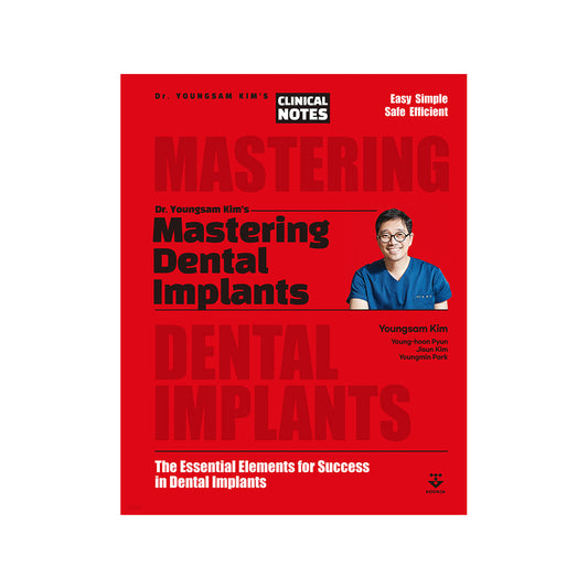 Mastering Dental Implants: The Essential Elements for Success in Dental Implants (English Edition)
